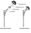 <b>Hip Replacement</b> Components