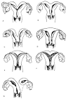 Volume 1, Chapter 4. Developmental Abnormalities of the Female ...