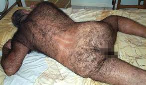 On a scale of 1-10 how hairy is your arse ? Images?q=tbn:ANd9GcTApska5DC5YW-MhjgK8rThai2nhC97Vs4pFlmk3UAmcAc9MUE&t=1&usg=__Dy6Zf0r0ihSLYQToXt89JDQuoaI=