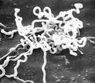 of <b>Treponema</b> pallidum on