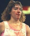 A bloodied Christy Martin looks on during her bout with Deirdre Gogarty in ... - 4387692