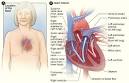 What Is <b>Heart Valve Disease</b>?