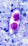oocysts of <b>Isospora</b> belli
