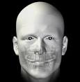 <b>Facial Trauma</b>