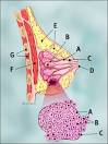 Invasive <b>Lobular Carcinoma</b>