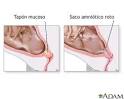 Por un parto respetado.: ¿Estoy de parto?