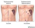 el abdomen, mientras el