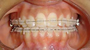  La Importancia de la Ortodoncia . . .