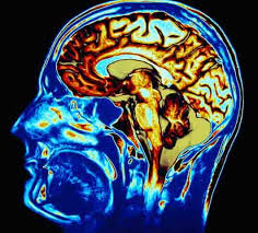 cpapandmore.files.wordpress.com/2009/03/brain-damage.jpg