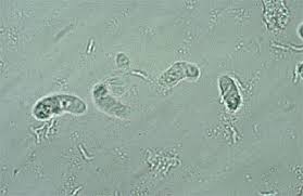 can become flagellated and