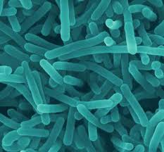 Listeria-monocytogenes.jpg