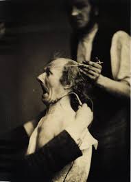 Duchenne de Boulogne was a