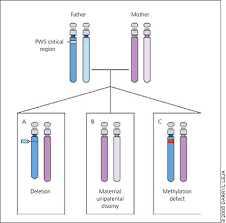 Prader-Willi Syndrome affects