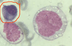 celula plasmatica