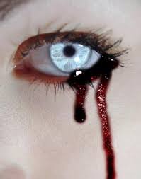 http://t1.gstatic.com/images?q=tbn:TjBxubF8lhMZ5M:http://c2.api.ning.com/files/lcSNh9HcvEOUPqp8dNMb53IGSD1S8ct0ClWhyBo8Orbbi9tC2dUSef4M5ltlNBlhNcFuS25ns1w5L6AXvwE-Wz-BgeIGNLF0/BloodyTears.jpg&t=1