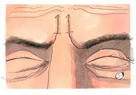 Vertical wrinkles on the