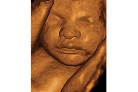 US Supreme Court made LEGAL the killing of unborn babies