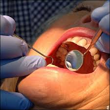 Dentists must not re-use