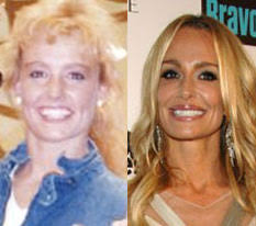 Taylor Armstrong Before And