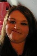 Parry Romberg syndrome is a