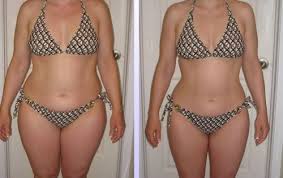 hcg weight loss - Before and