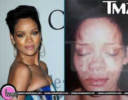 rihanna beat up pictures