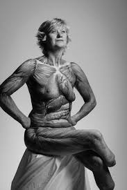 quad amputee nude|Blonde Quad Amputee Beauty Topless Big Breasts by bdgmy on DeviantArt