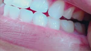 Easaatbaaaaaa auzerxcpynpl jpg x Teeth fetish