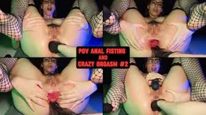 Teen pussy prolapse page jpg x Prolapse teen