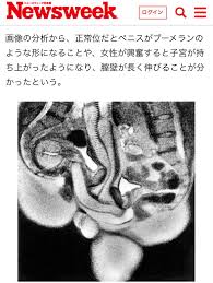 MRI まんこ|朗報】女の子「おまんこにスプレー缶入れたら蓋が取れなくなっちゃったの！」 : 女子アナお宝画像速報－5chまとめ