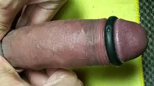 Dolor en el pene ¿a qué puede deberse jpg x Engrosar el pene