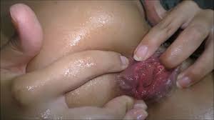 Anal prolapse videos free porn videos jpg x Anal prolapse