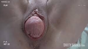 Image of wide open pussy prolapse pussy enormous open pussy hairy pussy jpg x Pussy prolapse