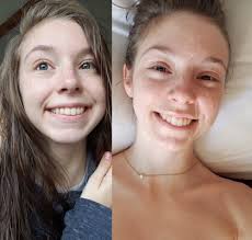 Before and after cum facials gallery jpg x After facial