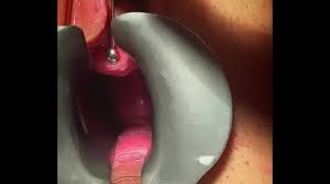 Dick peehole man fucking cock woman pee hole gif x Urethra orgasm