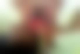 prepubertAL VAGINA|Treatment of Prepubertal Labial Adhesions with Topical Estriol +  Testosterone: A Case Report