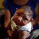 In Light of Zika Findings, Stepped-Up Monitoring of Children's Symptoms Urged 