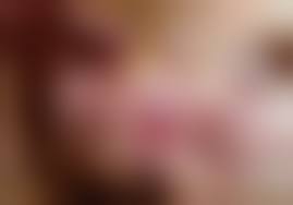 разрыв пизды|Опущение и выпадение женских половых органов — Википедия