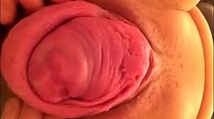 Fucking prolapse videos free porn videos jpg x Prolapse fucking