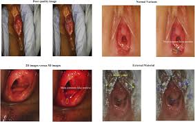 pedactric genital exam of child|Back Pediatric Orthopedic Exam | VuMedi