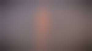 anorexic nudes|Anorexic Teen Girl Dela Strips Nude - Errotica-archives | Picture 06