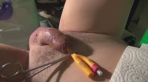 First time urethral sounding slugsofcumguy jpg x Urethral stimulation