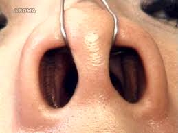 Nose tube jpg x Nose tube