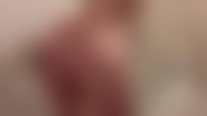 enema porn|Overwatch Pharmercy - Enema Play comic porn | HD Porn Comics