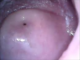 Cam in mouth vagina and ass jpg x Vagina mouth