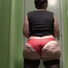 Cellulite ass jpg x Cellulite ass