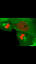 Hücre Bölünmesi: Temel Türler ve Etkileri ile ilgili video
