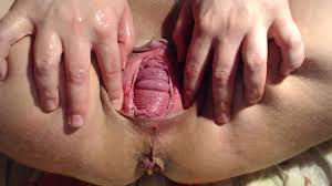 Perverted teen vixenxmoon loose her epic pussy prolapse jpg x Pussy prolapse