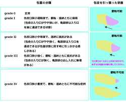 中学生包茎ちんこ|包茎はダメ、じゃない | NHKライフチャット