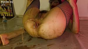Gaping prolapse jpg x Gaping prolapse